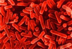 legionella bakterie