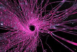 Neural1 Neural1