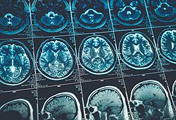 brain scan brain scan